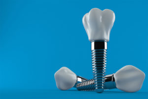 Dental Implants on a blue background