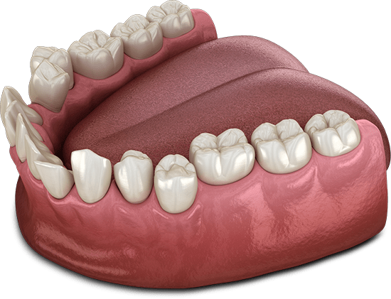 The image shows a detailed 3D rendering of a lower set of human teeth and gums. It depicts the natural anatomy of the mouth, including the teeth, gums, and tongue. The teeth are healthy-looking and well-aligned, providing a clear view of dental structure. This type of image is often used for educational purposes in dental care to explain various treatments or procedures