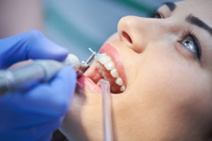 female getting a dental cleaning in a dental office, blurry background